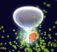 Artemis Biopsy - Urologist | UC Irvine Department of Urology