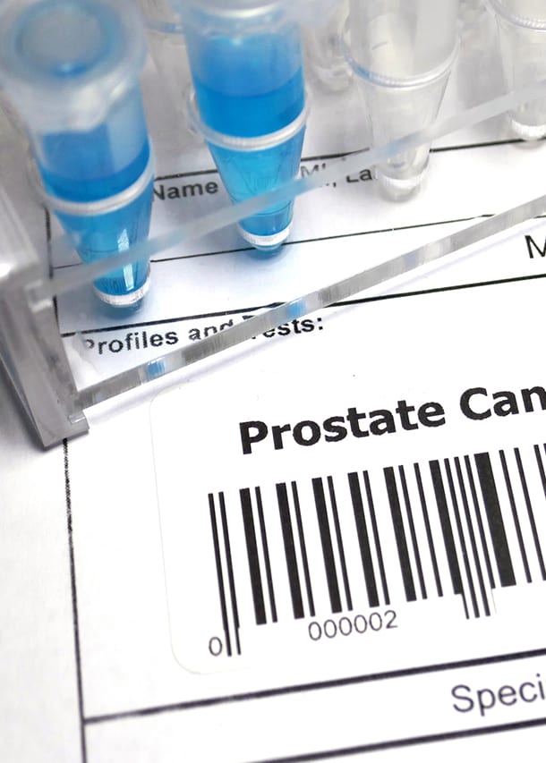 Procedure-order-form-for-prostate-cancer-SpaceOar-procedure-with-vials-of-liquid