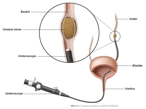 Endoscope_Anatomy