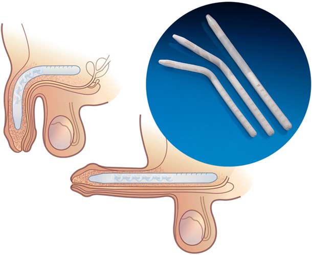 Genesis-product-anatomy