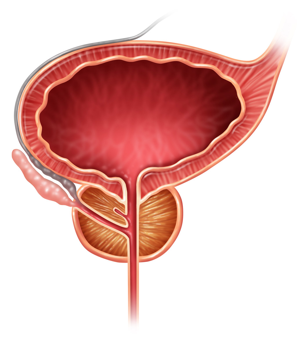 Illustration-of-a-prostate-gland-before-SpaceOar-procedure