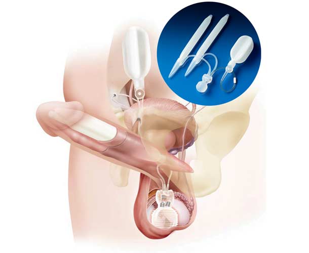 Titan-Touch-product-anatomy