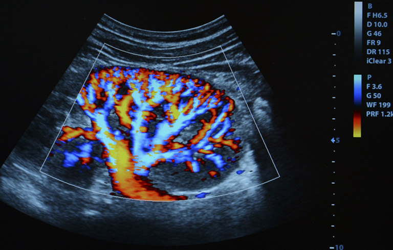 nephrectomy-imaging