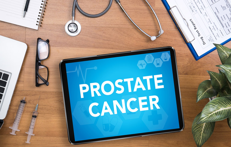 prostate-cancer-UCI-Urology