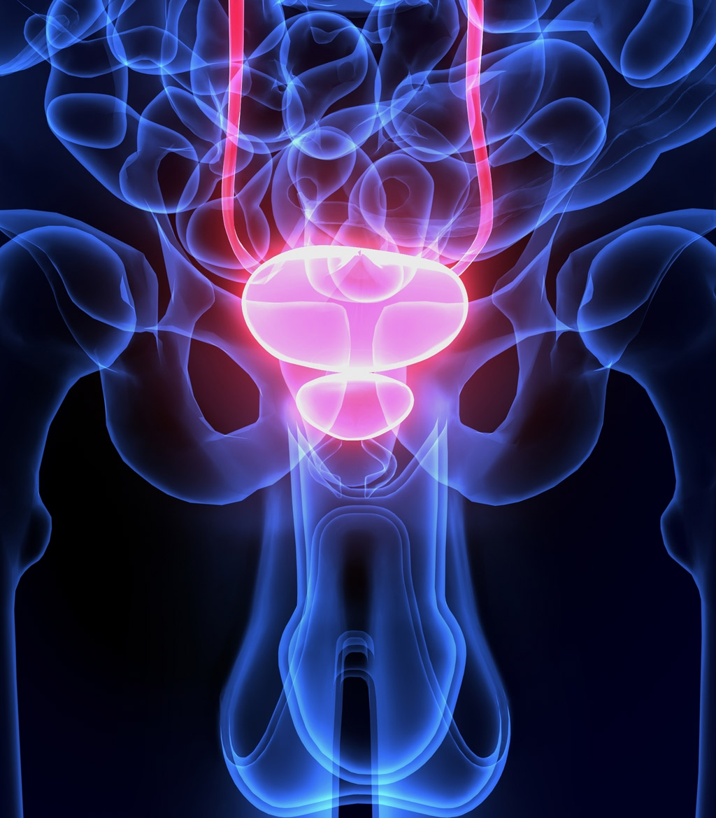 prostate-isolated-prostate-biopsy-UCI-Urology