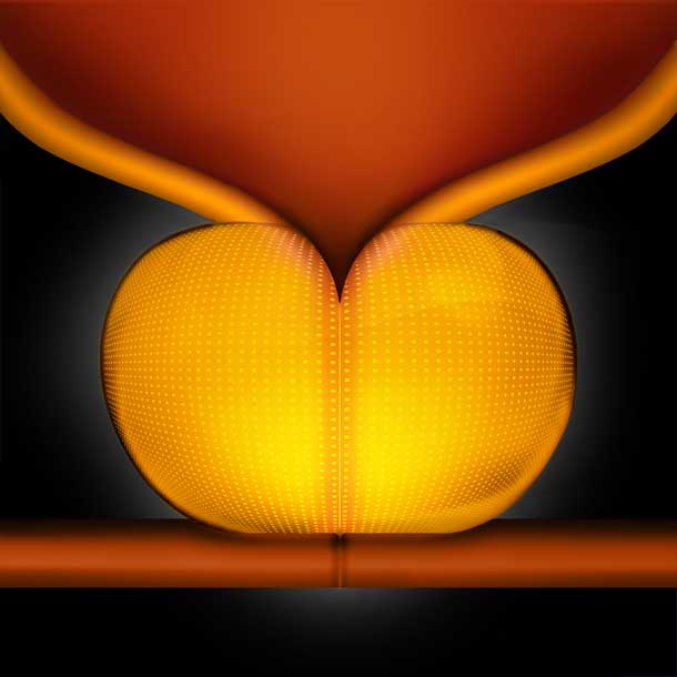 prostate-master-org-step-1