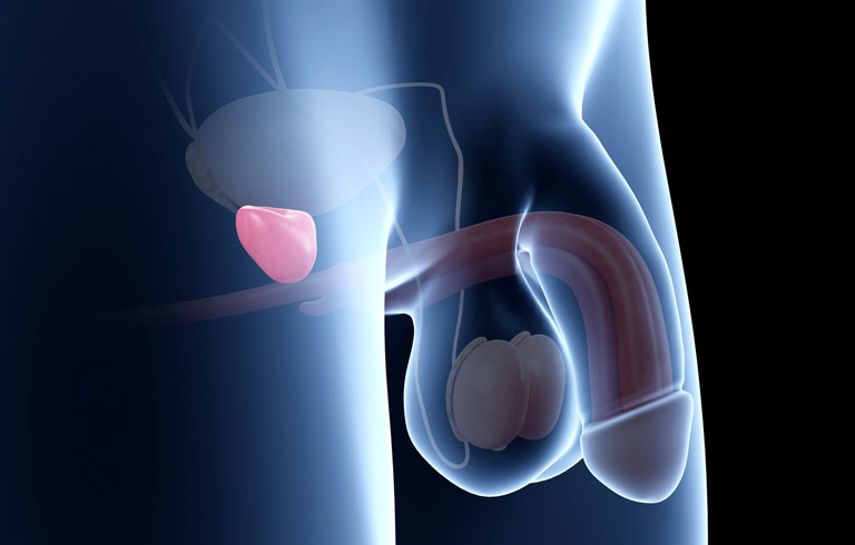 prostatectomy-anatomy