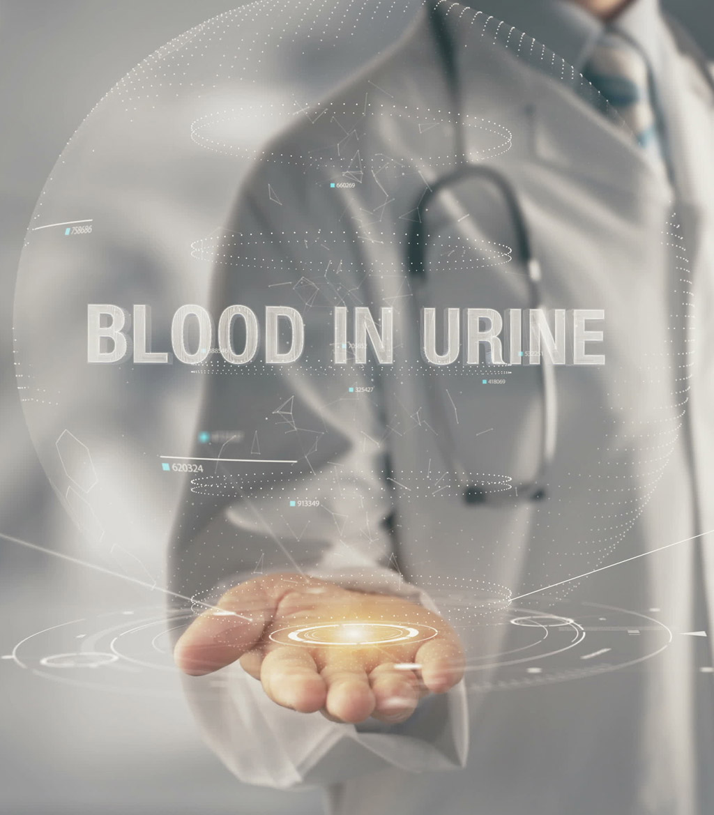 specialist-focusing-on-hematuria