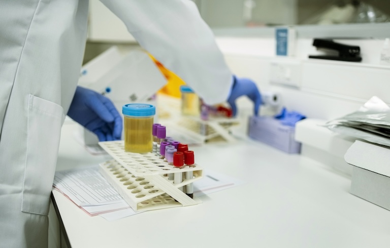 close-up of a lab technician working with blood and urine samples