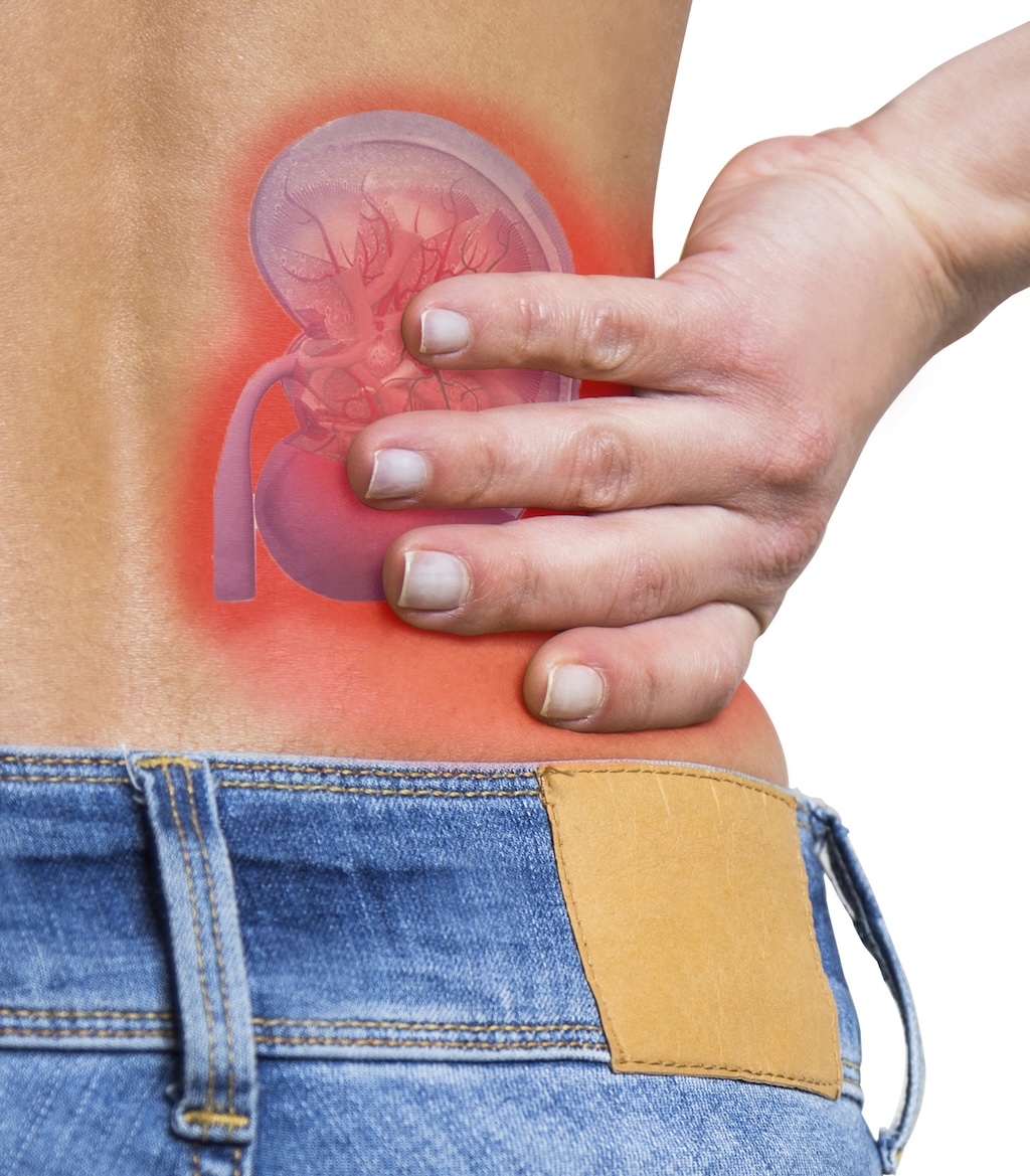 patient holding back with kidney pain illustration