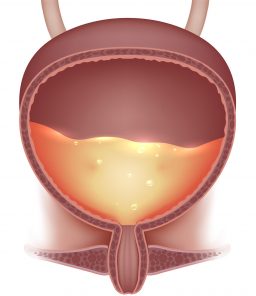 Bladder-Instillations