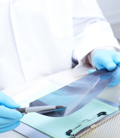 Discussing-Lymph-Node-Dissection-1