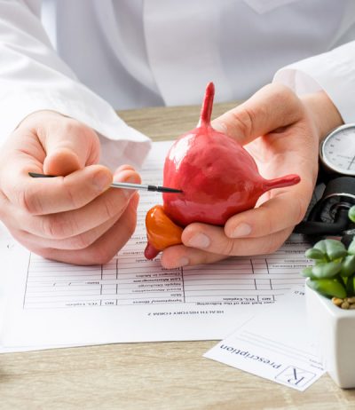 Physician-holding-a-model-of-a-bladder-and-explaining-Blue-Light-Cystoscopy-procedure