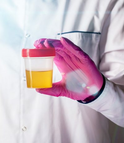 doctor wearing pink glove and holding a urine sample cup